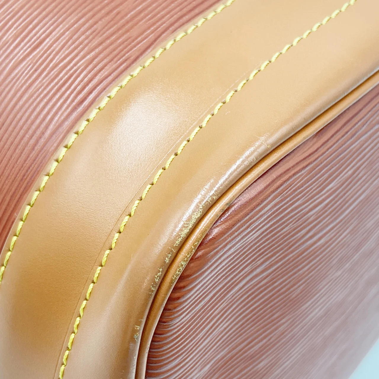 LV EPI NOE (BROWN) view 4